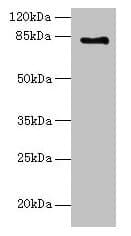 Polyclonal Rabbit anti-Human LCA5 Antibody