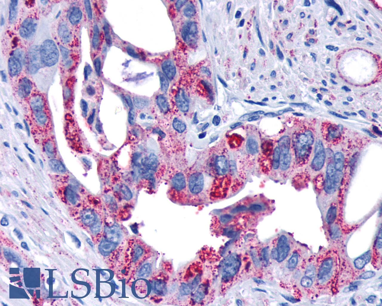 IHC-plus™ FZD4 / Frizzled 4 Antibody (N-Terminus)