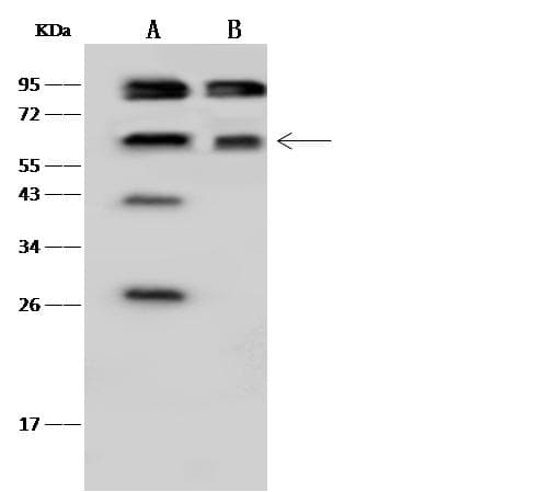 Polyclonal Rabbit anti-Human TKT / Transketolase Antibody (Preservative Free, IF, WB)
