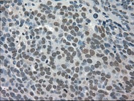 TRIB2 Antibody (clone OTI8D11)