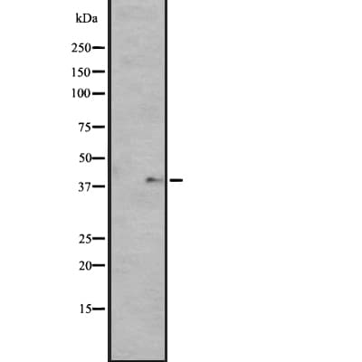 OPN5 / Neuropsin Antibody