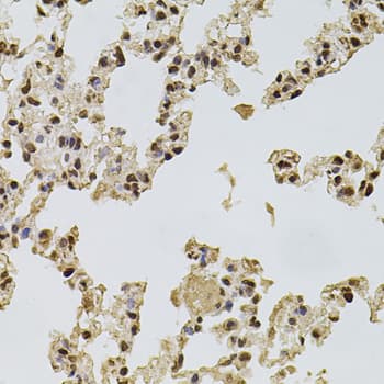 FGF2 / Basic FGF Antibody
