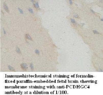 PCDHGC4 Antibody (aa380-642)