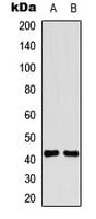 Polyclonal Rabbit anti-Human TRAIL-R4 / DCR2 Antibody (Internal, WB)