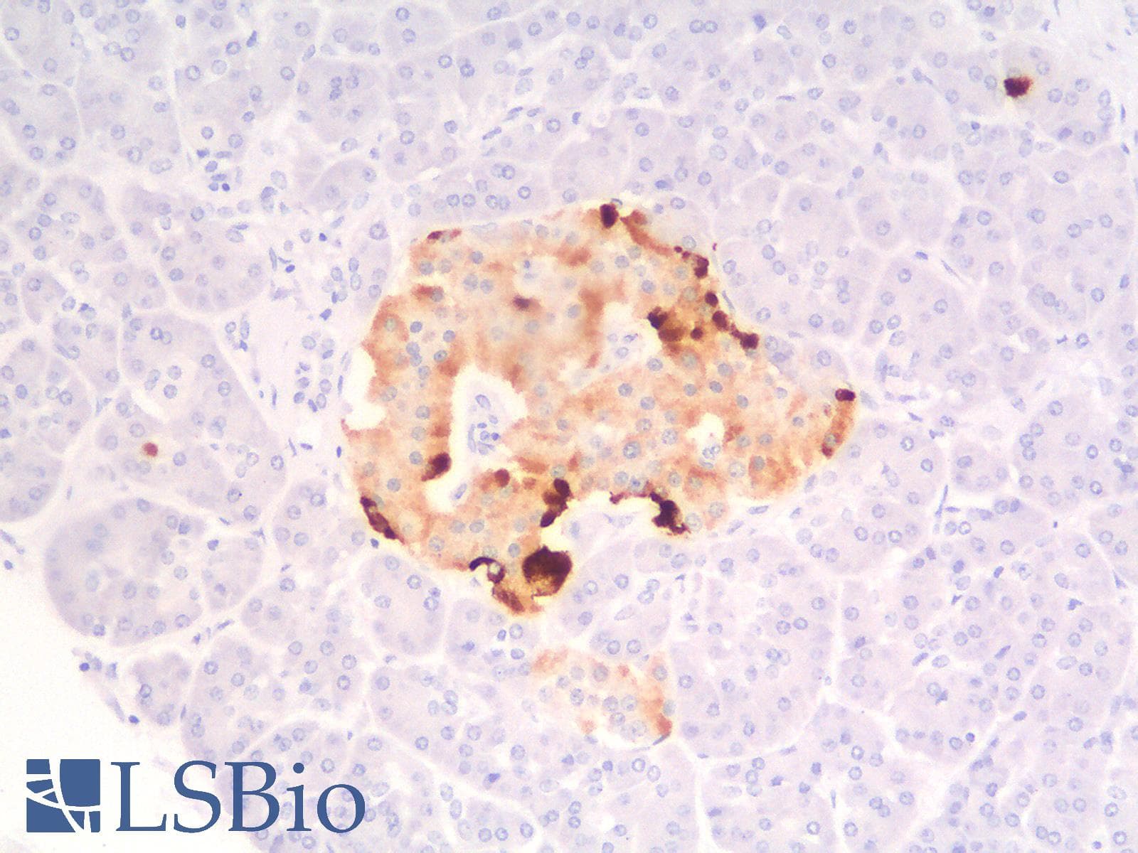 PathPlus™ Recombinant Monoclonal Rabbit anti-Human CHGA / Chromogranin A Antibody (clone CHGA/1815R, IHC)