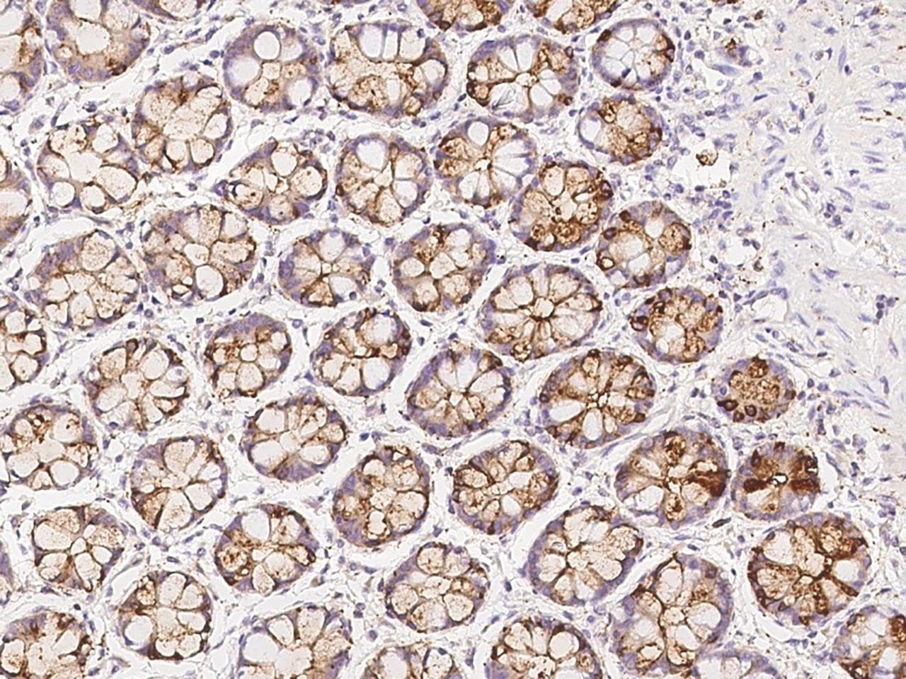 Polyclonal Rabbit anti-Human AP1G2 Antibody (IHC)