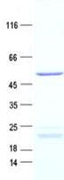 Mouse CAMK2D / CaMKII Delta Protein (Recombinant DDK,C-terminus)
