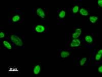 DDX17 Antibody (clone 2248C2a)