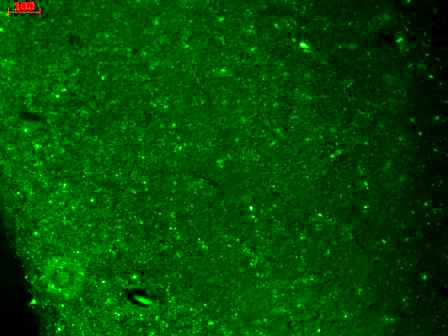 CACNA1H / Cav3.2 Antibody (aa1019-1293, clone S55-10, APC)