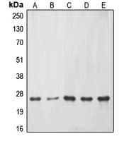 ERAS Antibody (C-Terminus)