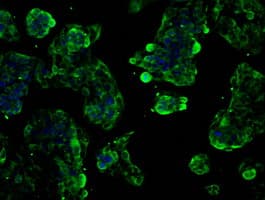 SLC2A5 / GLUT5 Antibody (clone OTI20E1)