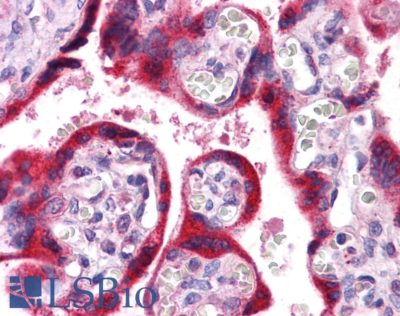 IHC-plus™ ATP6V1D / V-ATPase subunit D Antibody (clone 3G4)