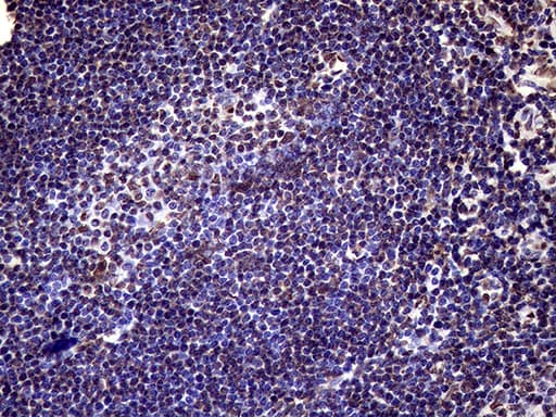 XRN2 Antibody (aa677-779, clone OTI5F4)