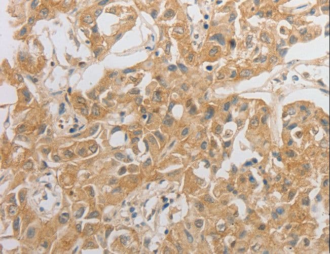 OX2R / Orexin Receptor 2 Antibody