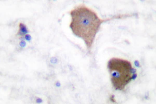 NOL3 / ARC Antibody (Glu194)