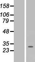 Cardiolipin Synthase / CRLS1 Protein (Over-Expression Lysate Myc-DDK (Flag))