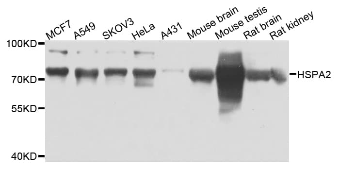 HSPA2 Antibody