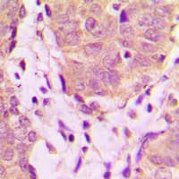 UBXN11 / SOC Antibody (Internal)