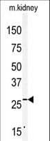 Polyclonal Rabbit anti-Human CLDN2 / Claudin 2 Antibody (aa190-220, WB)