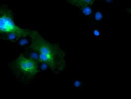 Monoclonal Mouse anti-Human FXYD3 Antibody (clone OTI1E8, IHC, IF, WB)