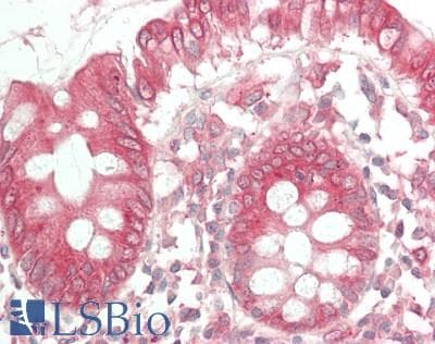 IHC-plus™ Polyclonal Rabbit anti-Human NEI3 / NEIL3 Antibody (aa491-540, IHC, WB)
