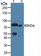 F2 / Prothrombin / Thrombin Antibody (Biotin)