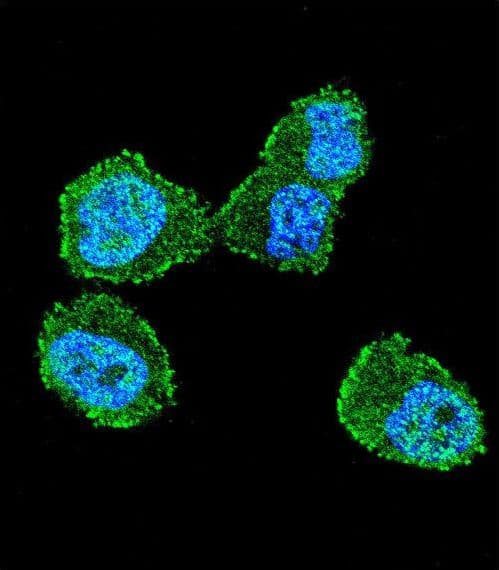 STK11 / LKB1 Antibody (aa19-48)