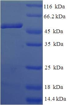 Human CIAPIN1 / Anamorsin Protein (Recombinant His-SUMO)