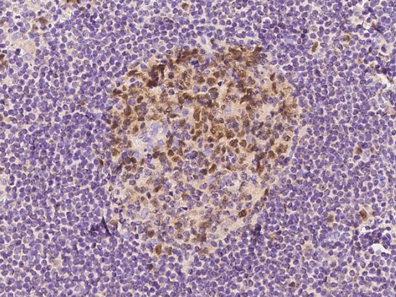 Polyclonal Rabbit anti-Human DUT / DUTPase Antibody (IHC)
