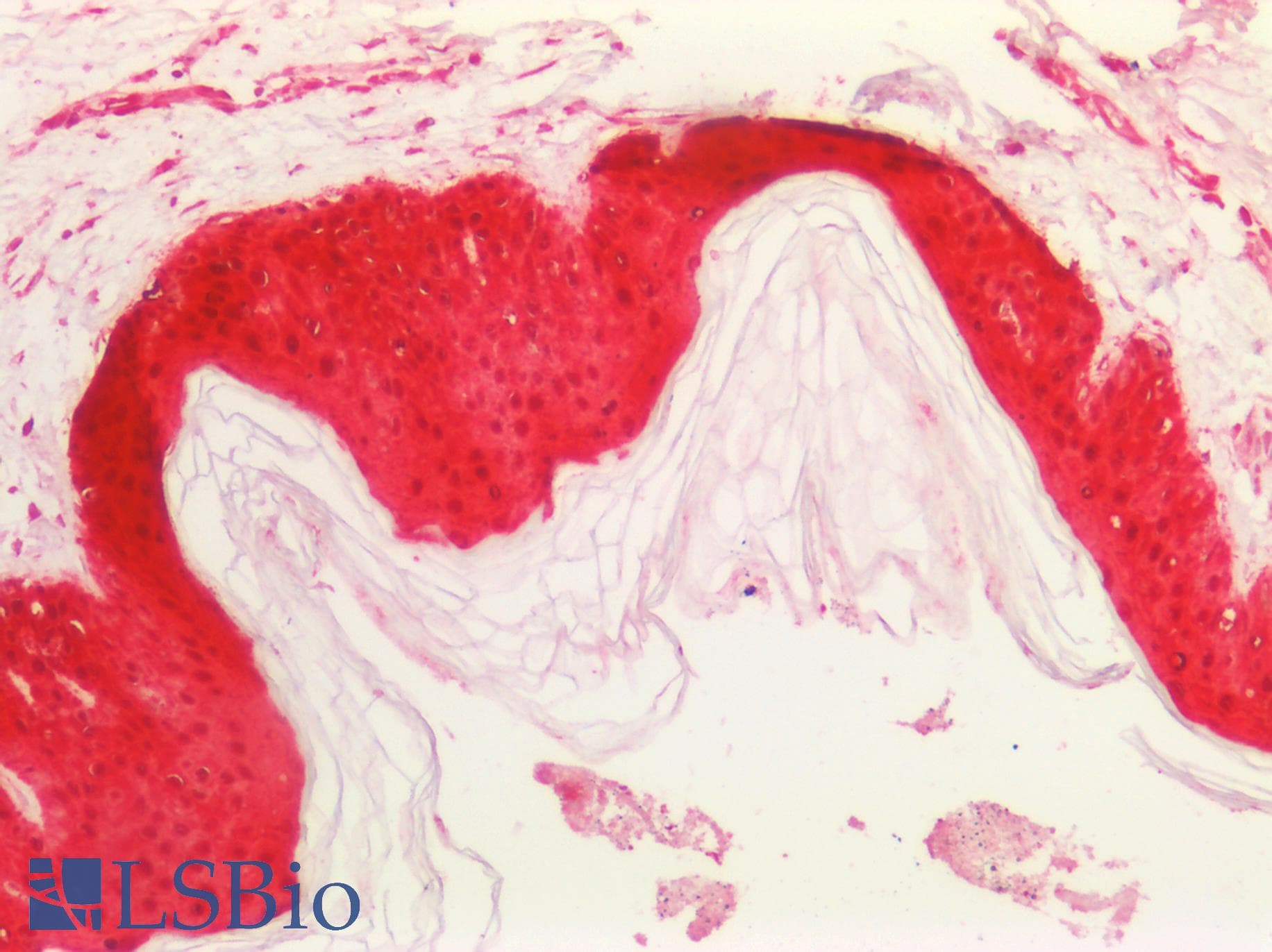 PathPlus™ SERPINB5 / Maspin Antibody