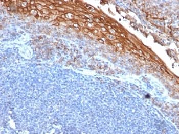 MCAM / CD146 Antibody (clone MUC18/1130)