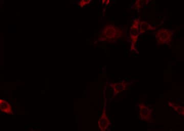 CNKSR2 Antibody