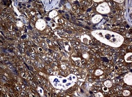 NME1 / NM23 Antibody (clone OTI2D8)