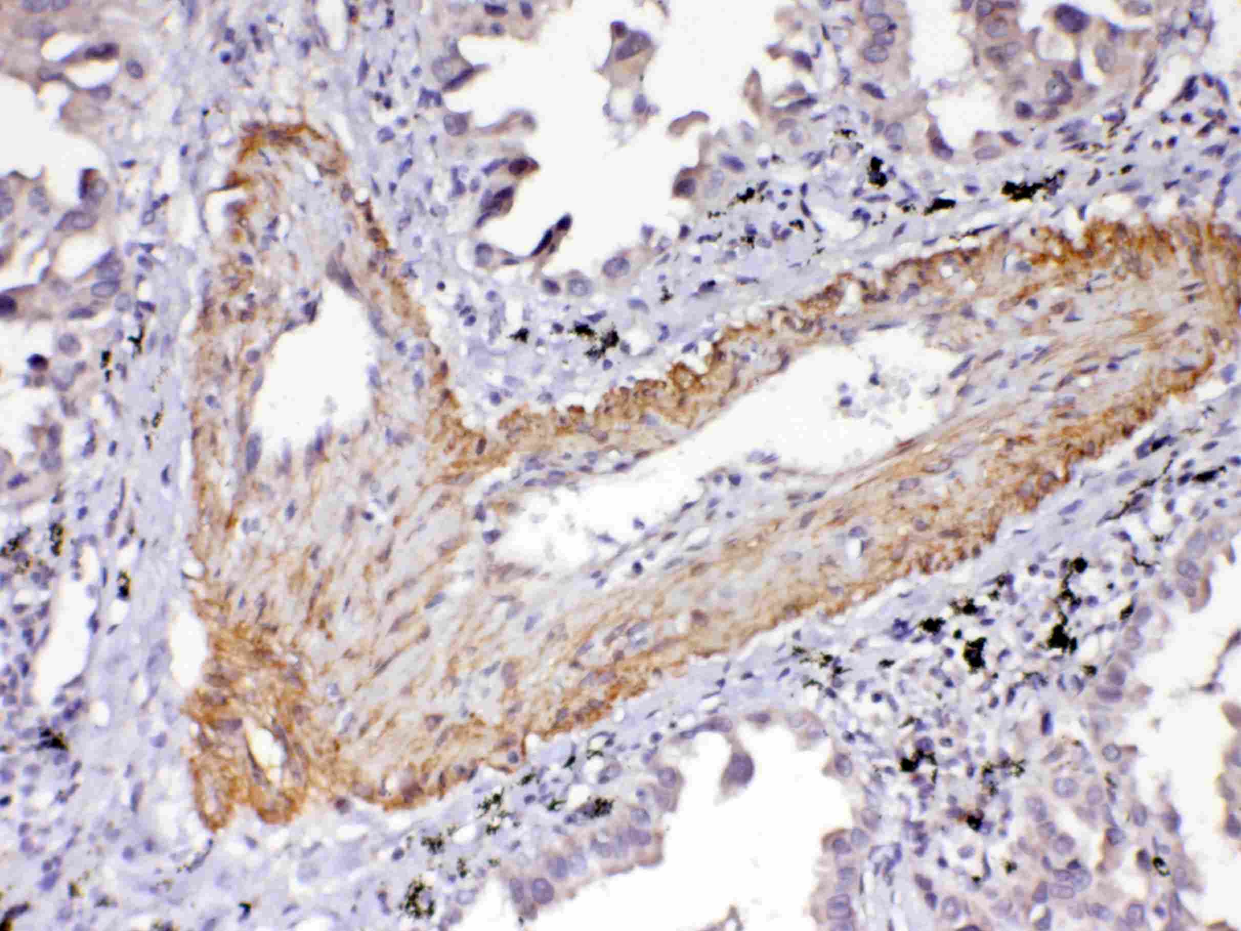 KDR / VEGFR2 / FLK1 Antibody