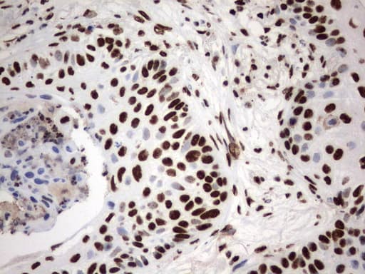 MLF1 Antibody (clone UMAB138)
