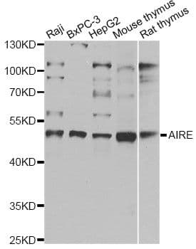 AIRE Antibody