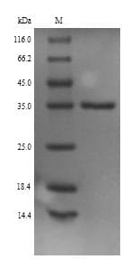 Mouse MGLL / Monoacylglycerol Lipase Protein (Recombinant 6His, N-terminus)