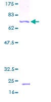 Human TIMM13 Protein (Recombinant GST)