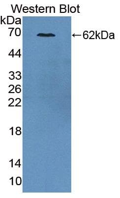 CKAP2 Antibody