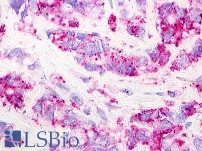 PathPlus™ GPR62 Antibody (C-Terminus)