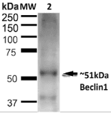 Polyclonal Rabbit anti-Human BECN1 / Beclin-1 Antibody (IF, WB)