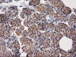 CTNNB1 / Beta Catenin Antibody (clone OTI6A3)
