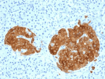 GAD65 Antibody (clone GAD2/1960)