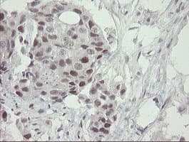 RFC2 / RFC40 Antibody (clone OTI5A1)