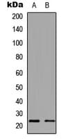 NDUFB9 Antibody (Internal)