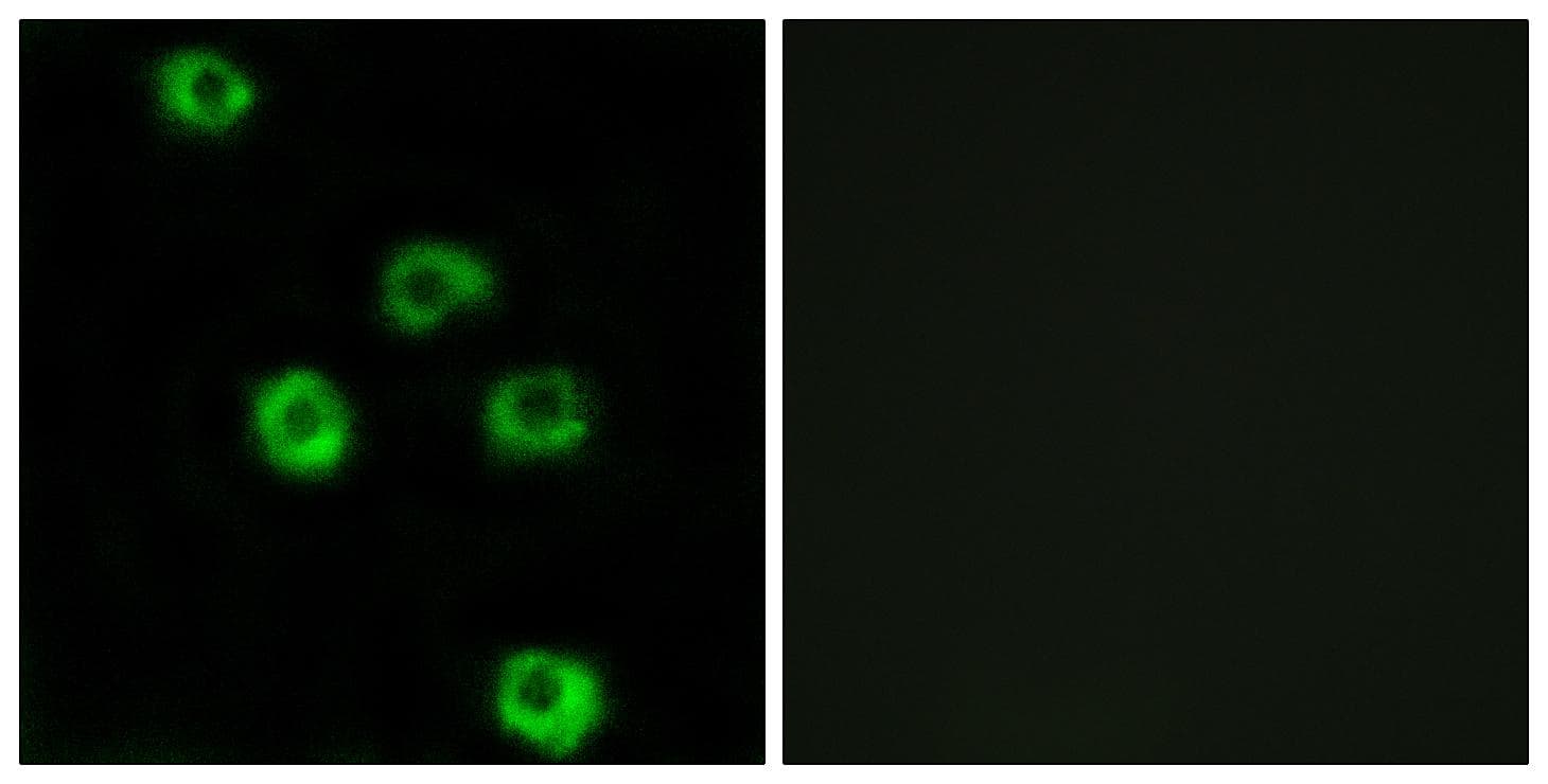 ADGRL2 / LPHN2 Antibody