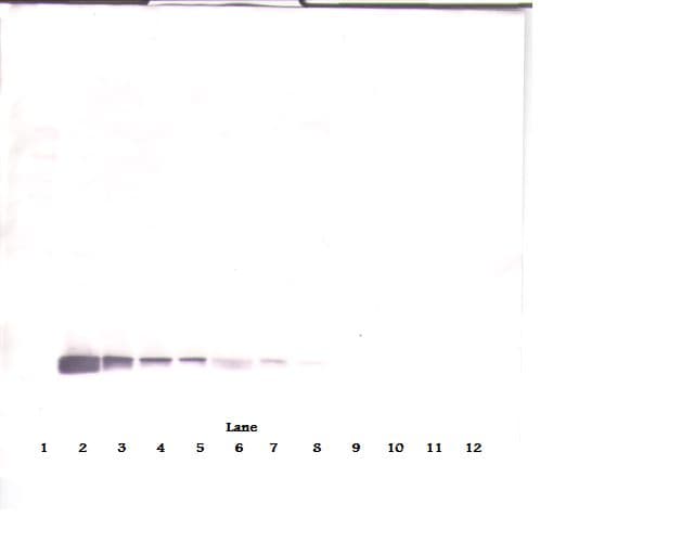 IHC-plus™ Polyclonal Rabbit anti-Human Endostatin Antibody (IHC, WB)