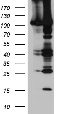 Polyclonal Rabbit anti-Human EPHA4 / EPH Receptor A4 Antibody (WB)