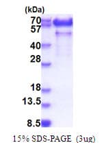 Human Paralemmin / PALM Protein (Recombinant His)