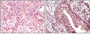 EPHB6 / EPH Receptor B6 Antibody (clone 8E7H12)